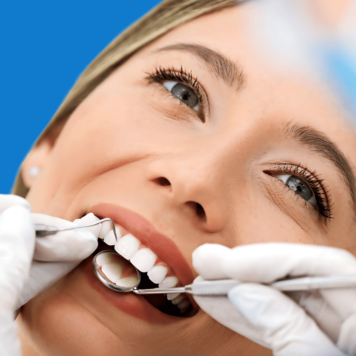 Diseño de sonrisa profesional