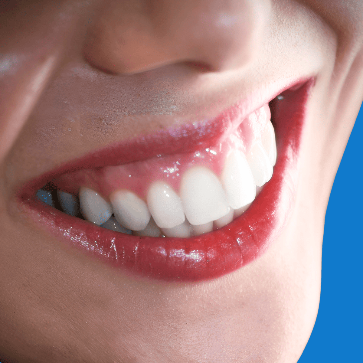 Corrección de sonrisa en Bogotá