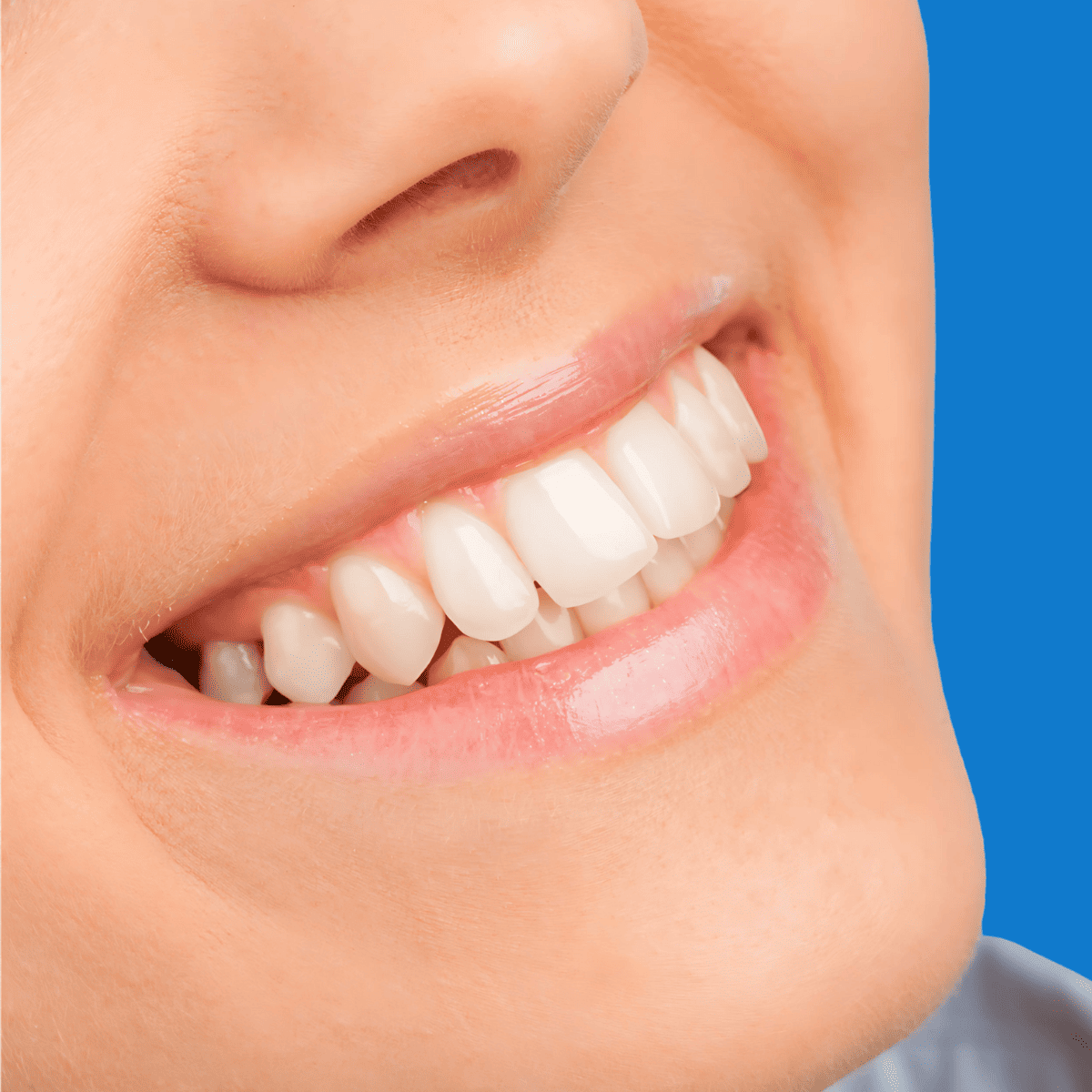 Diseño personalizado de sonrisa en Bogotá