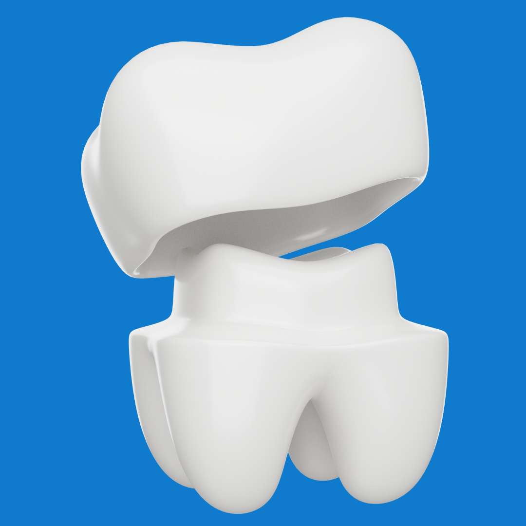 Urgencias Odontológicas en Bogotá | 24 horas Dr. José Rojas 5 Danos esteticos en carillas o coronas