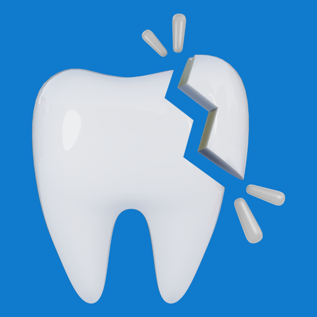 Urgencias Odontológicas en Bogotá | 24 horas Dr. José Rojas 3 Fraccturas dentales