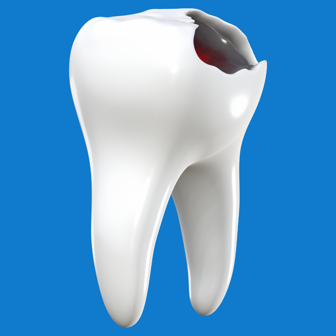 Urgencias Odontológicas en Bogotá | 24 horas Dr. José Rojas 7 Golpes por accidente