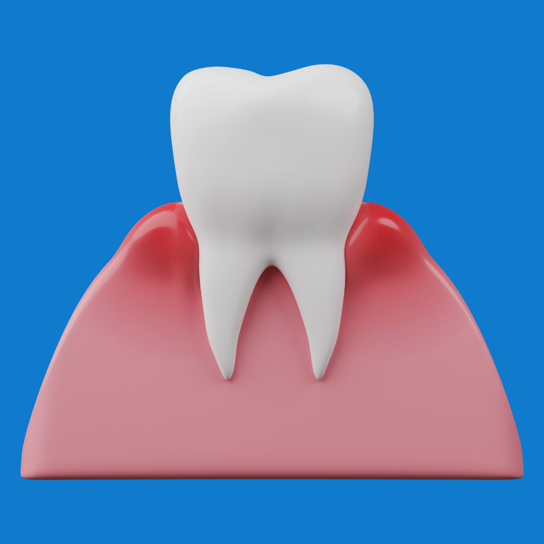 Urgencias Odontológicas en Bogotá | 24 horas Dr. José Rojas 6 Sangrado o inflamacion