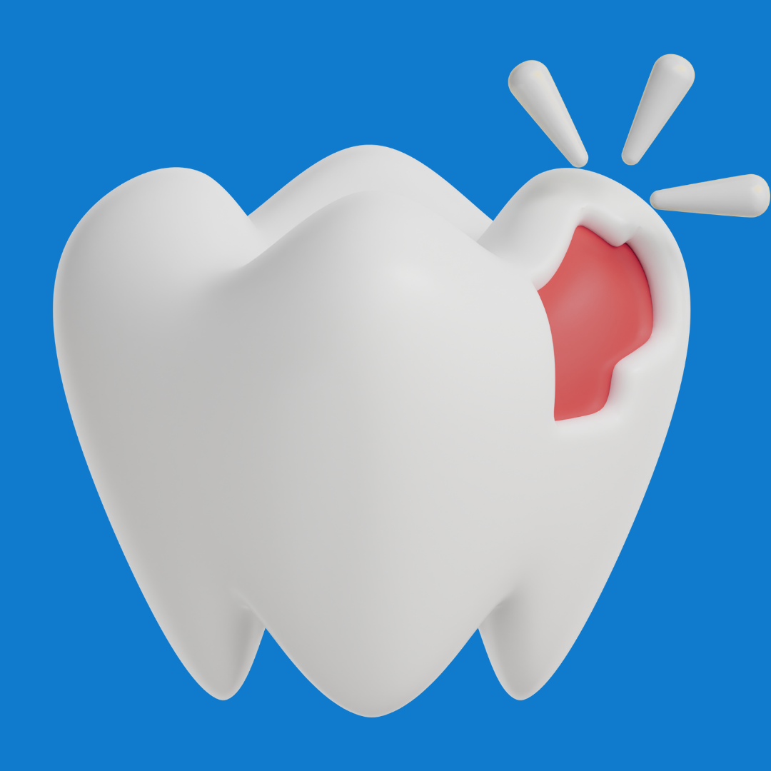 Urgencias Odontológicas en Bogotá | 24 horas Dr. José Rojas 2 Trauma dento alveolar