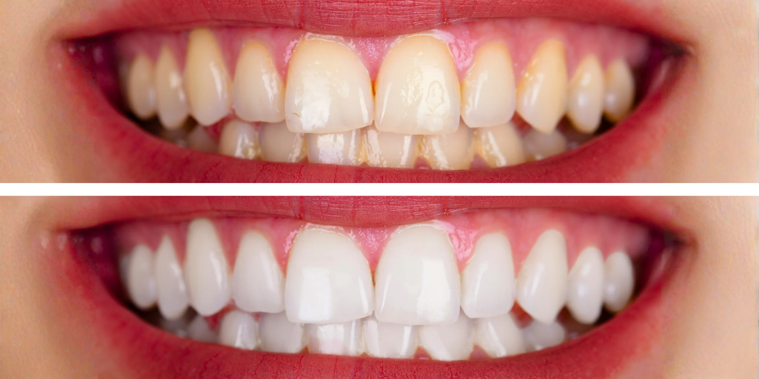 Urgencias Odontológicas en Bogotá | 24 horas Dr. José Rojas 2 Diseno de sonrisa antes y despues 4 scaled