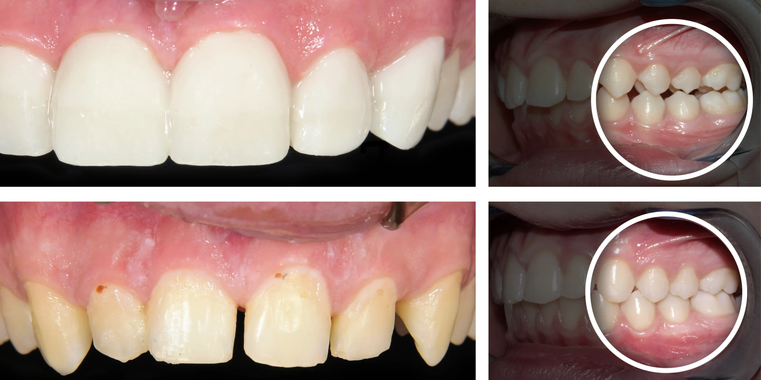 Urgencias Odontológicas en Bogotá | 24 horas Dr. José Rojas 4 Diseno de sonrisa antes y despues 5 scaled