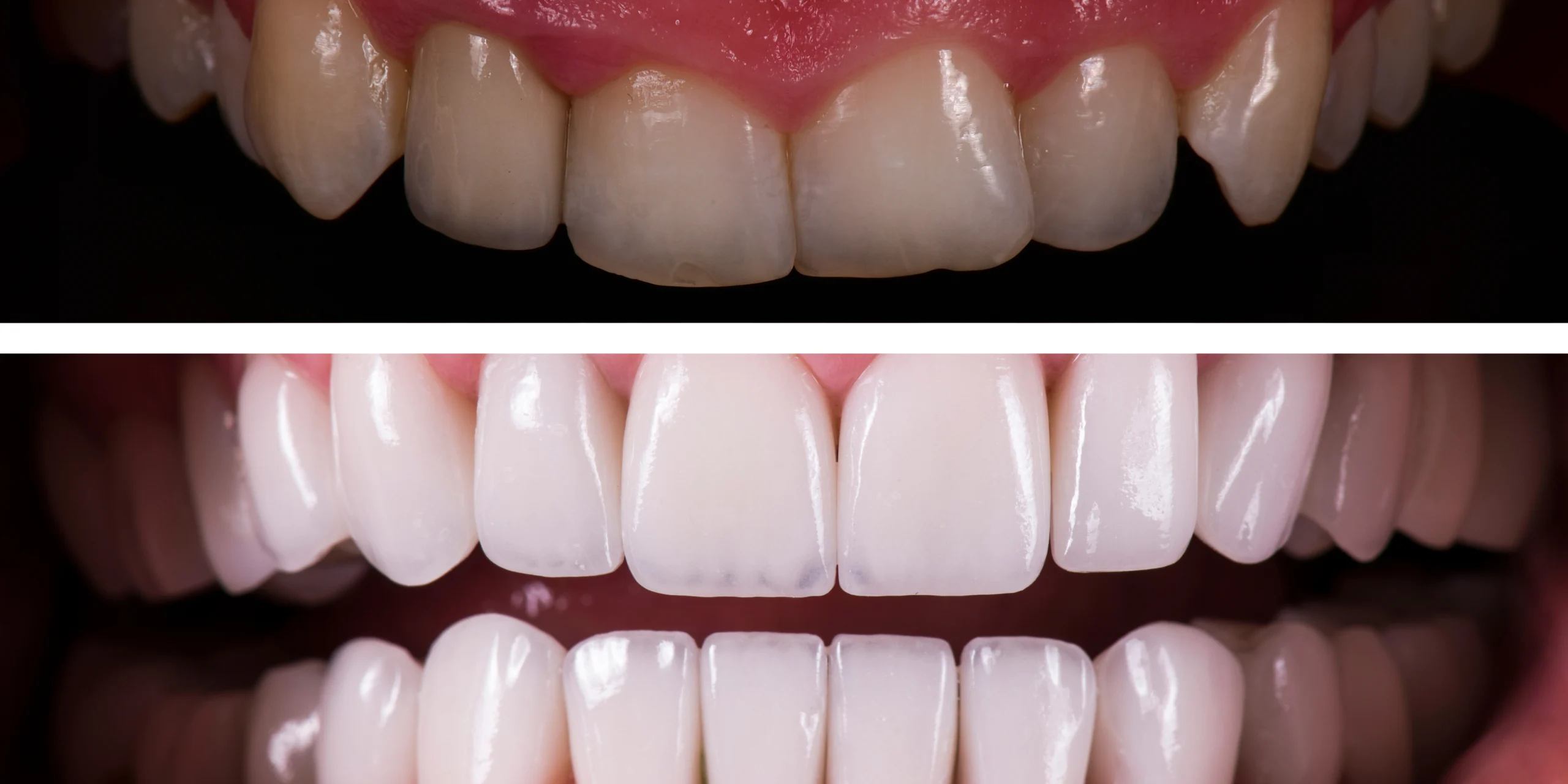 Urgencias Odontológicas en Bogotá | 24 horas Dr. José Rojas 3 Diseno de sonrisa antes y despues 6 scaled